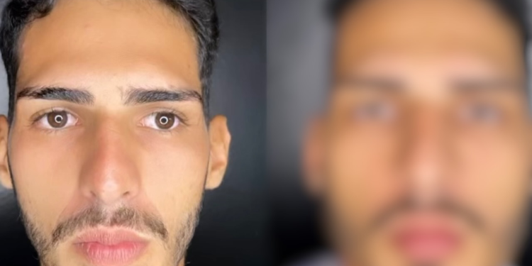 ‘Tá a mesma coisa’, dizem seguidores após Agenor Tupinambá revelar resultado final de harmonização facial; vídeo