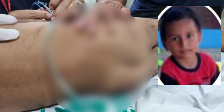 Garotinho de 3 anos espancado pelo pai no AM morre após 3 dias internado em Manaus