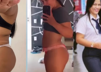 Talarica da Bemol posta antes e depois e afirma que não está mais barriguda