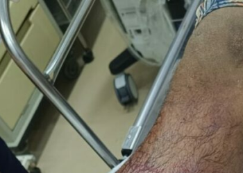 Traficantes espancam e dão tiros nas duas pernas de homem como forma de ‘recado’ na Redenção