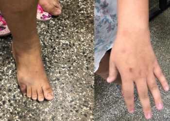 Inconformado com fim de relação, homem é preso em Manaus após espancar ex-enteada