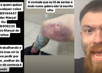 DJ Maluco, preso por agredir a tia e baleado pela PM, volta às redes tocando o terror e pedindo dinheiro