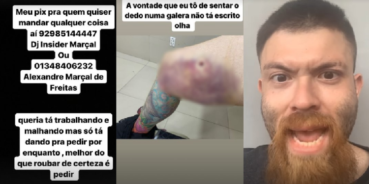 DJ Maluco, preso por agredir a tia e baleado pela PM, volta às redes tocando o terror e pedindo dinheiro