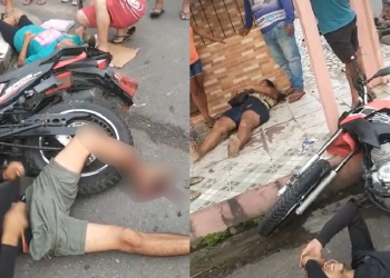 Motociclista tem fratura exposta após acidente com outra moto e pedestre no Santa Etelvina; vídeo