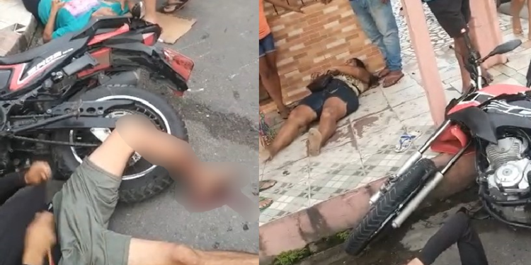 Motociclista tem fratura exposta após acidente com outra moto e pedestre no Santa Etelvina; vídeo