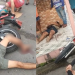 Motociclista tem fratura exposta após acidente com outra moto e pedestre no Santa Etelvina; vídeo