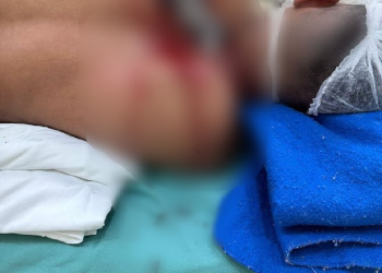 Querendo dinheiro, mulher é presa após deixar faca cravada em homem em Manaus