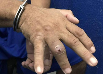 Técnica de quebrar dedos de presos é denunciada em cinco estados do Brasil