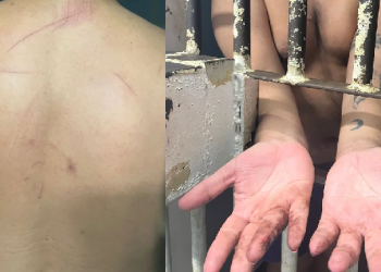 Irmãos são torturados dentro do Batalhão da PM de Manaus e justiça considera prisão ilegal