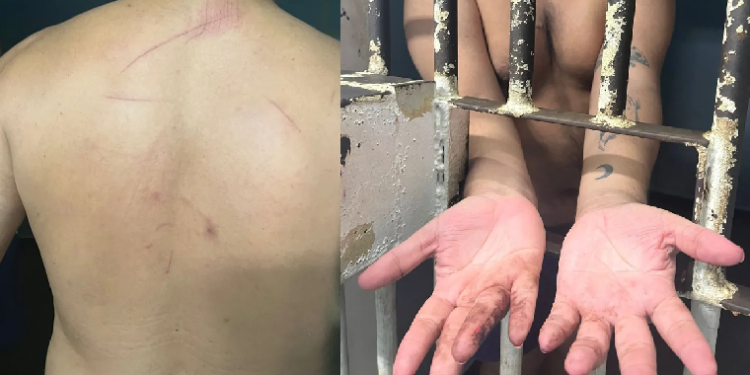 Irmãos são torturados dentro do Batalhão da PM de Manaus e justiça considera prisão ilegal