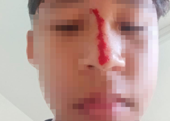 Corpo de homem é encontrado no igarapé do Mindu