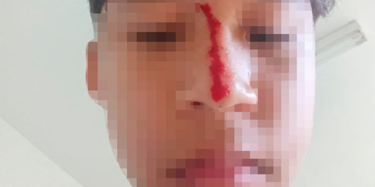 Corpo de homem é encontrado no igarapé do Mindu