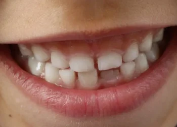 Cientistas desenvolvem medicamento que faz os dentes crescerem novamente