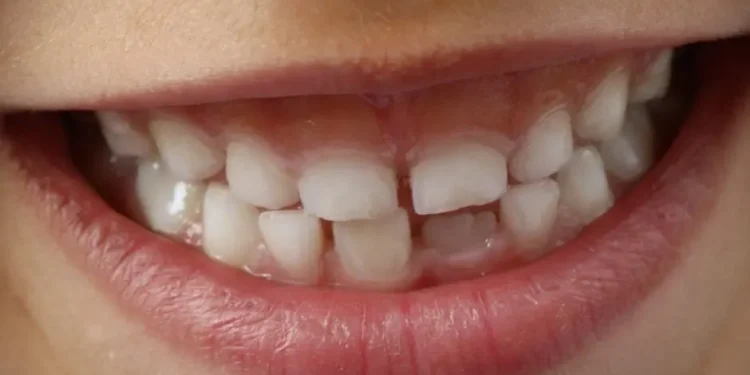 Cientistas desenvolvem medicamento que faz os dentes crescerem novamente