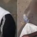 Homem é abandonado por hospital com pernas amputadas, fraldas e sonda