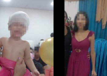 Criança fica com a cabeça arrebentada após receber golpes de enxada da tia em Manaus