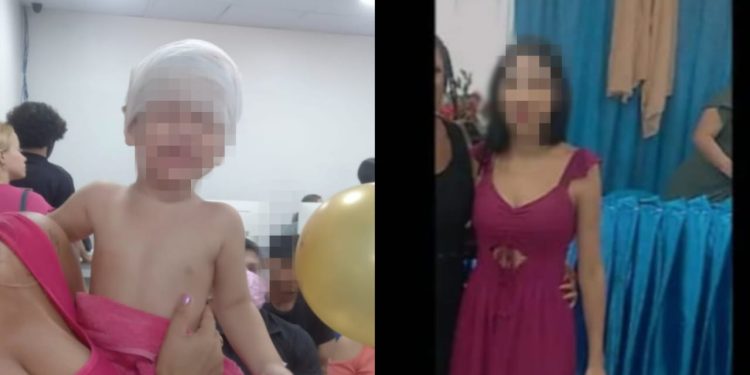 Criança fica com a cabeça arrebentada após receber golpes de enxada da tia em Manaus
