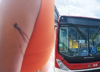 Professora é esfaqueada em assalto ao 600 na Autaz Mirim: ‘eu resisti’