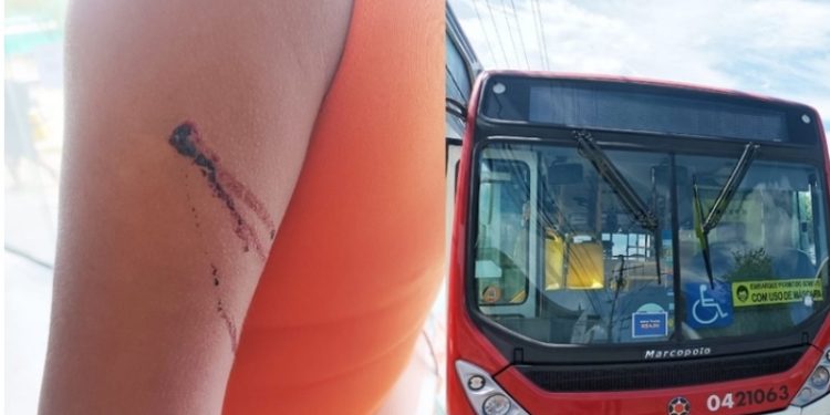 Professora é esfaqueada em assalto ao 600 na Autaz Mirim: ‘eu resisti’