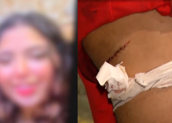 Revoltada com o fim da relação, mulher esfaqueia o ex ‘novinho’ com estilete