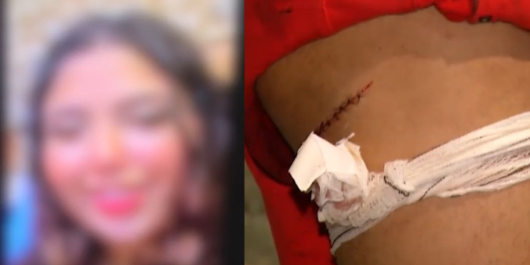Revoltada com o fim da relação, mulher esfaqueia o ex ‘novinho’ com estilete