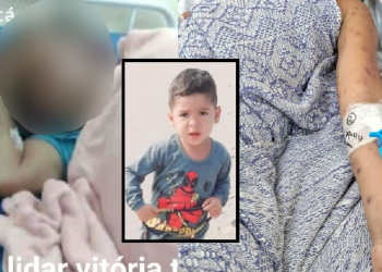 Menino morre e avô fica em estado grave após ninho de caba cair em cima deles em Coari