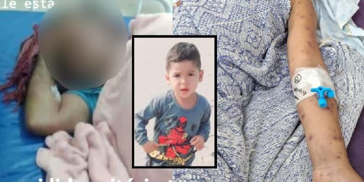 Menino morre e avô fica em estado grave após ninho de caba cair em cima deles em Coari