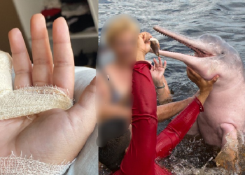 ‘Quase vou de Lula por um boto’, revela mulher após susto ao ter pedaço do dedo rasgado em praia no Amazonas