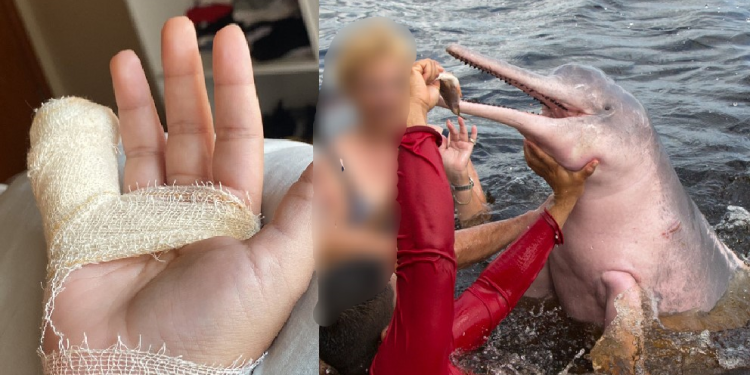 ‘Quase vou de Lula por um boto’, revela mulher após susto ao ter pedaço do dedo rasgado em praia no Amazonas