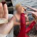 ‘Quase vou de Lula por um boto’, revela mulher após susto ao ter pedaço do dedo rasgado em praia no Amazonas