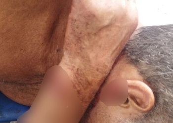 ‘Revolta é demais’, diz sobrinha de idoso de 70 anos todo ‘ticado’ com terçado em assalto em Coari