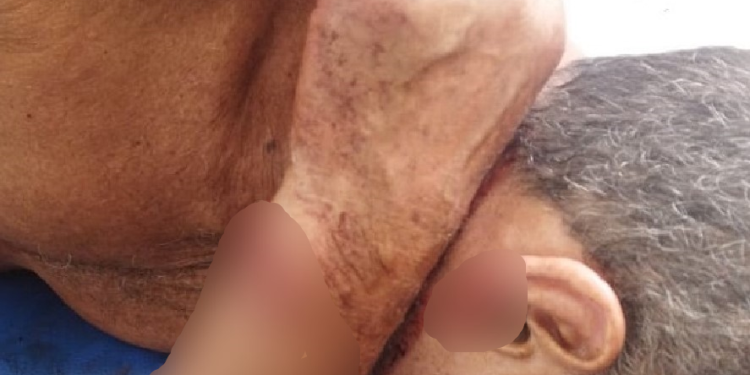 ‘Revolta é demais’, diz sobrinha de idoso de 70 anos todo ‘ticado’ com terçado em assalto em Coari