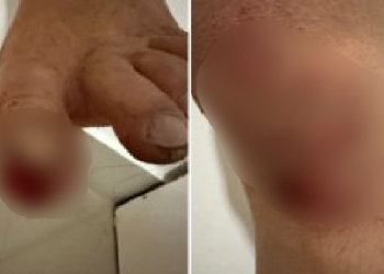 Na Ponta Negra, família é assaltada e agredida: ‘E a polícia não faz nada’; vídeo