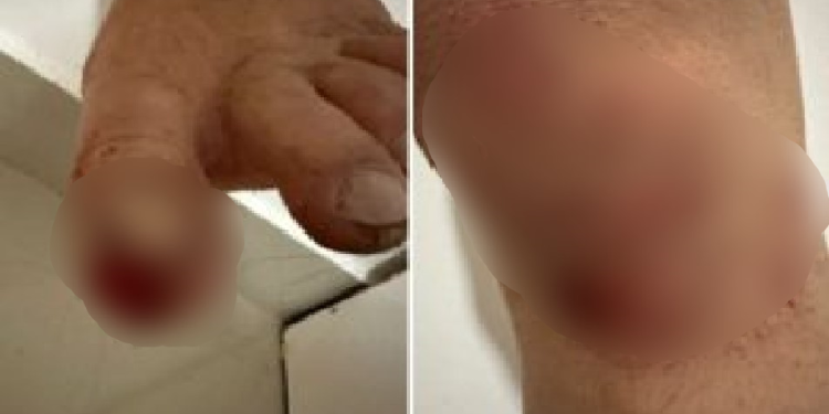 Na Ponta Negra, família é assaltada e agredida: ‘E a polícia não faz nada’; vídeo