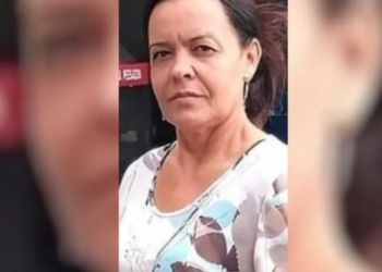 Mulher tenta separar briga de cães e morre com rosto desfigurado e sem uma das mãos