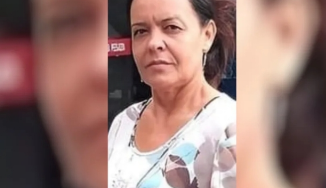 Mulher tenta separar briga de cães e morre com rosto desfigurado e sem uma das mãos
