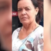 Mulher tenta separar briga de cães e morre com rosto desfigurado e sem uma das mãos