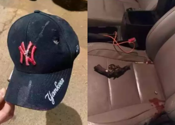 Chefe de quadrilha leva quatro tiros na cabeça e sobrevive; um dos tiros entrou pela cabeça e saiu na nuca