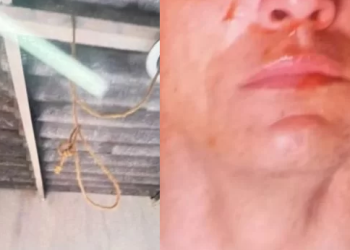 Denunciado pela namorada, homem simula suicídio com molho de tomate e corda