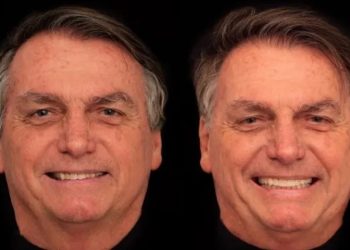 Bolsonaro arruma os dentes, o cabelo e gasta R$ 84 mil para ficar com cara de príncipe