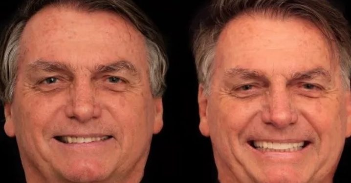 Bolsonaro arruma os dentes, o cabelo e gasta R$ 84 mil para ficar com cara de príncipe