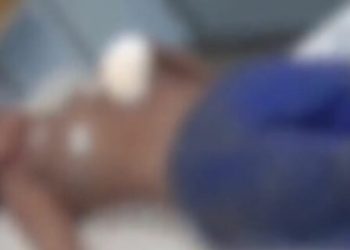 Suposto assaltante da Compensa leva tiros nas mãos e pés após sentença do ‘Tribunal do Crime’