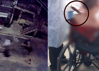 Vídeo: Homem marca encontro com mulher na Compensa, cai em ‘casinha’ e fica com faca cravada no couro