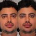Homem faz procedimento estético para ficar com os olhos azuis