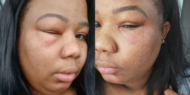 Motorista de app diz que foi agredida por casal e ofendida de ‘crente do rabo quente’ por ouvir gospel