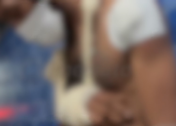 Jurado de morte, homem fica três dias no cativeiro e tem o dedo decepado em Manaus