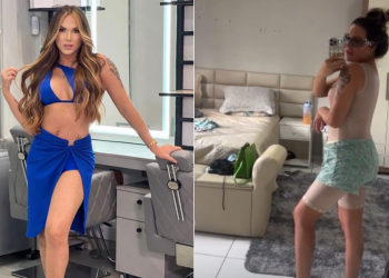 Sereia Lima comemora lipo na barriga, troca de silicone e empinada no bumbum; veja como ficou