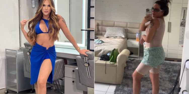 Sereia Lima comemora lipo na barriga, troca de silicone e empinada no bumbum; veja como ficou