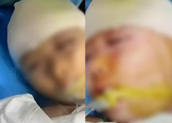 Menina fica internada com traumatismo craniano após ser agredida por professor