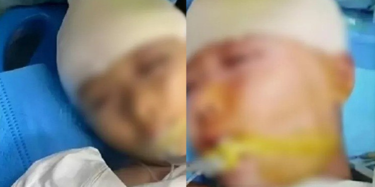 Menina fica internada com traumatismo craniano após ser agredida por professor